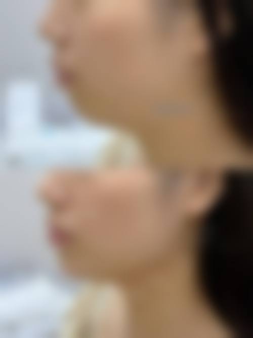 四平英俊医疗美容诊所治疗反馈与口碑评价。