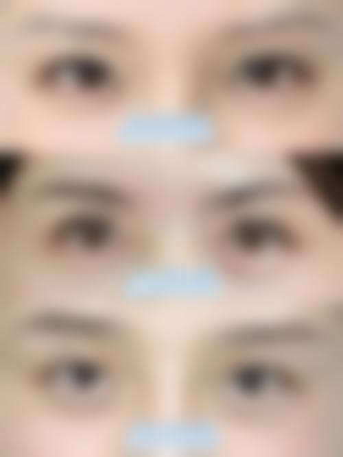 特色项目与优势:个性化方案,成效更自然