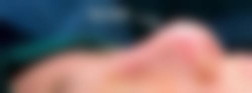 临床实例分享