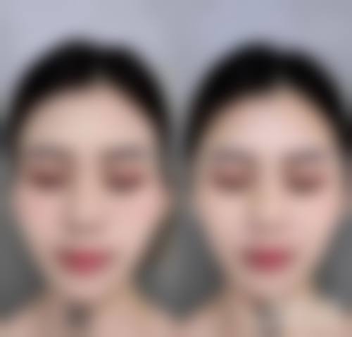 长春莱美整形美容门诊部医生团队经验稳定。