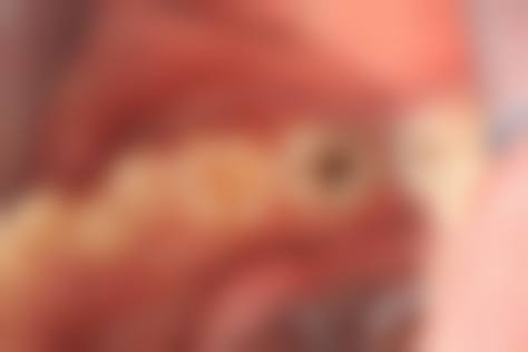 广东珠海泊菲特口腔医生团队经验稳定。