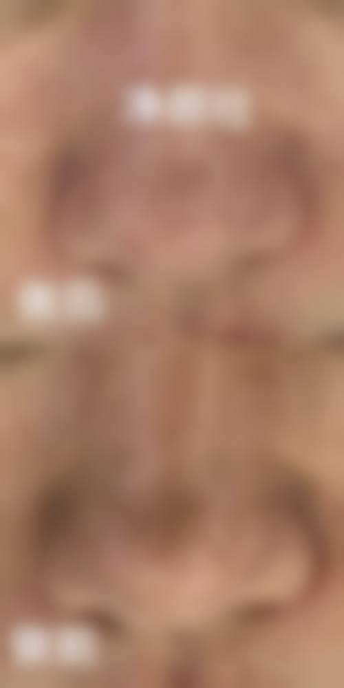 优惠活动详情