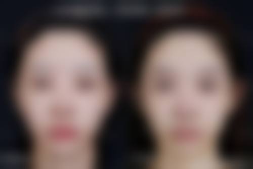 擅长项目详解
