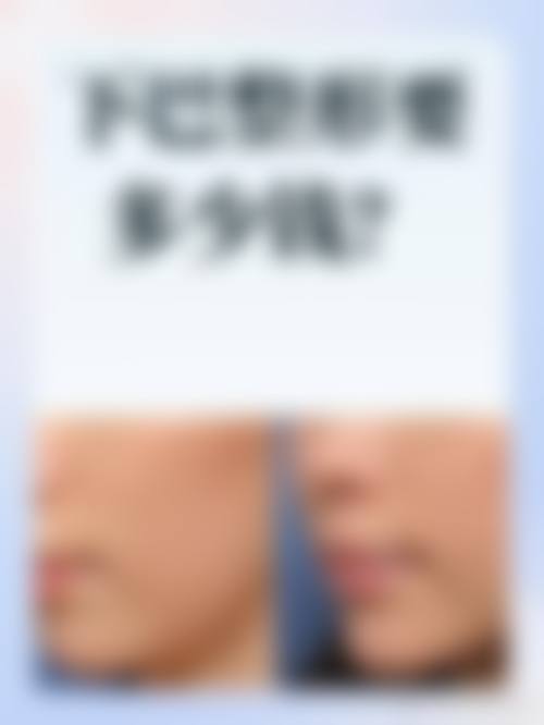 沈阳艾希颜美容整形门诊部口碑评价反馈