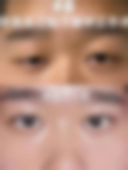 临床实例分享