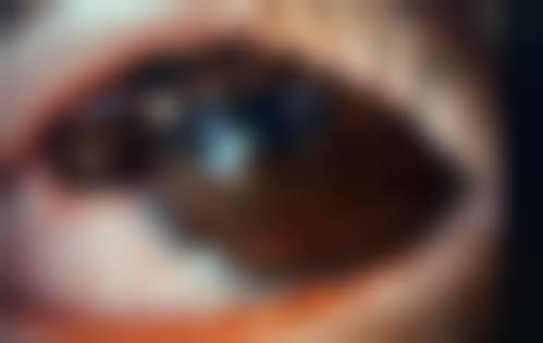 临床实例分享:马秋艳医生的治疗实例成效如何?
