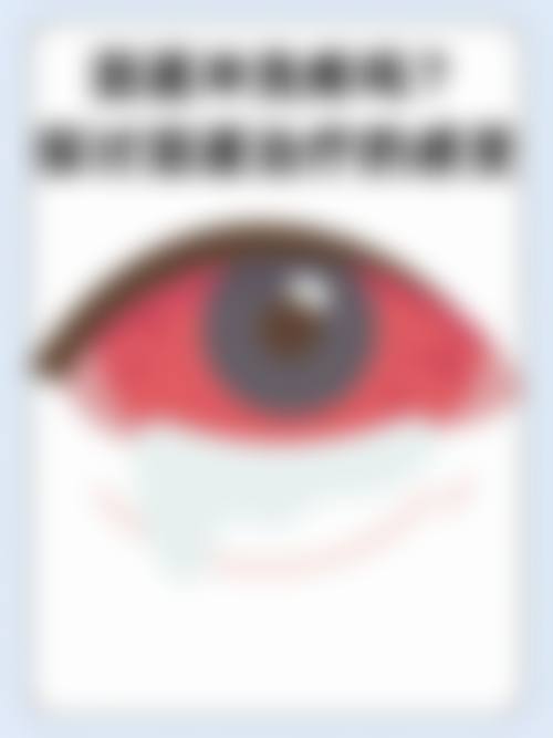 擅长项目详解:马秋艳医生能解决我的眼病问题吗?
