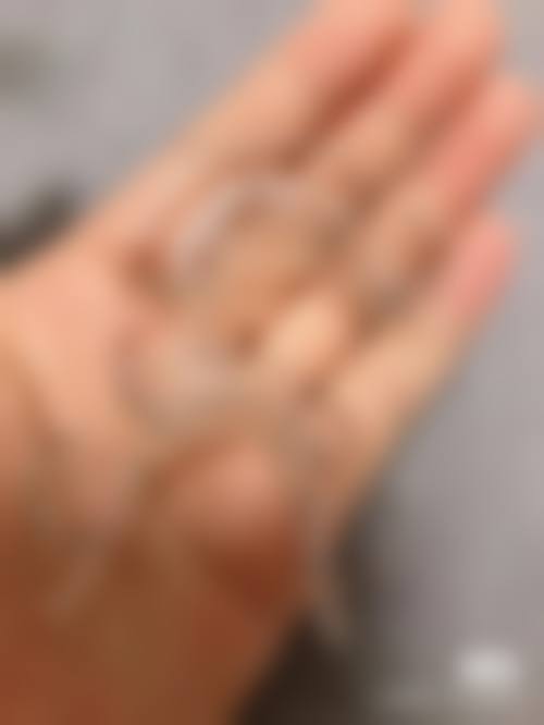 优惠活动详情：多项口腔项目享惊喜价