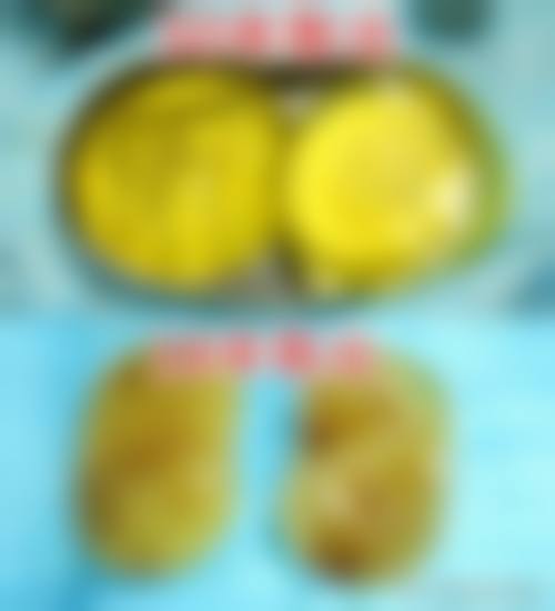 天津御芝堂医疗美容医院治疗反馈与口碑评价。