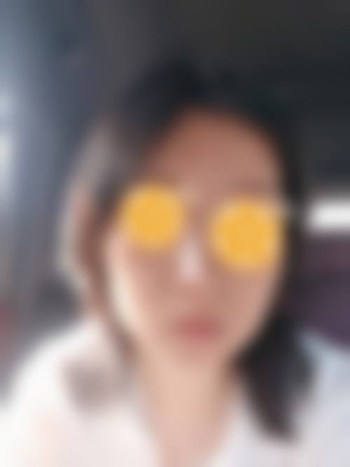 临沧时代伊美整形医院设备保护服务安心。