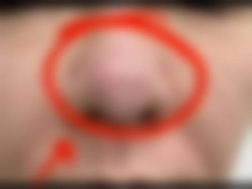 服务流程与患者保护:贴心周到,全程呵护