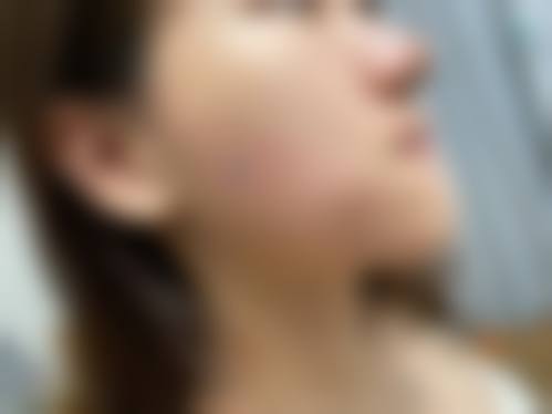 天津御芝堂医疗美容医院擅长项目。