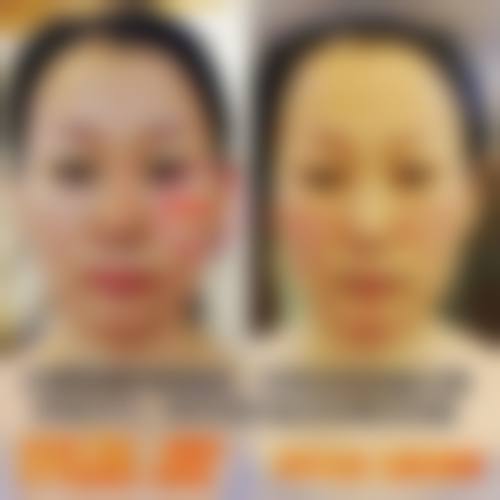 擅长项目详解