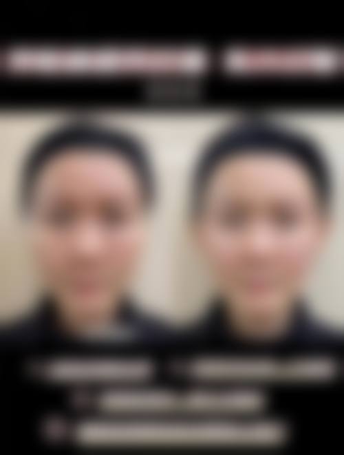 临沧时代伊美整形医院预约挂号方式。