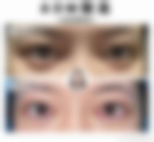 优惠活动详情:限时特别优惠·到店有礼