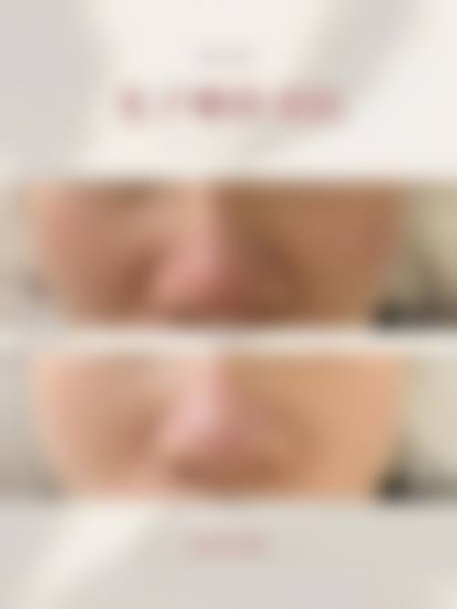 天津市甜橙贞睿医疗美容诊所擅长项目。