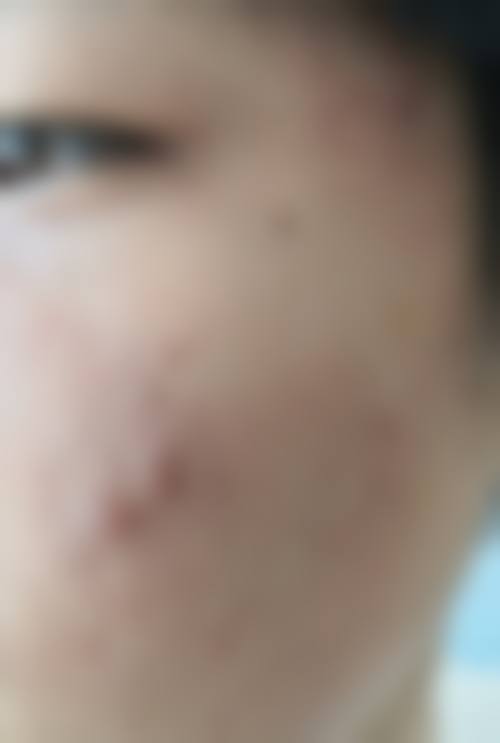 宜兴市人民医院医疗美容科治疗反馈与口碑评价。