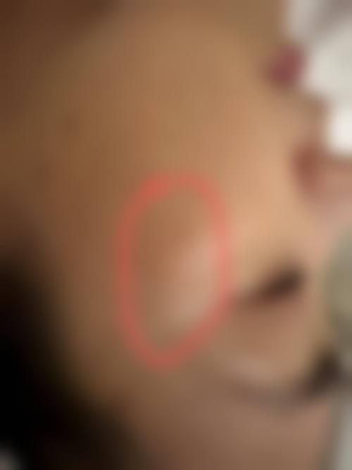 长沙翡萃整形医院擅长项目。