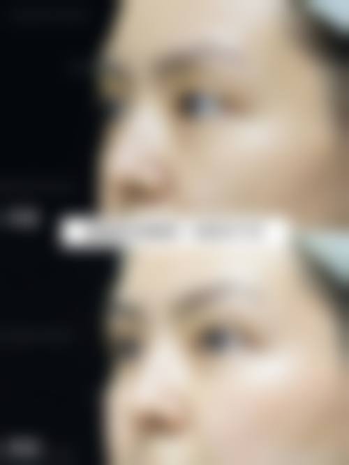 宜兴市人民医院医疗美容科2026年价格收费表: