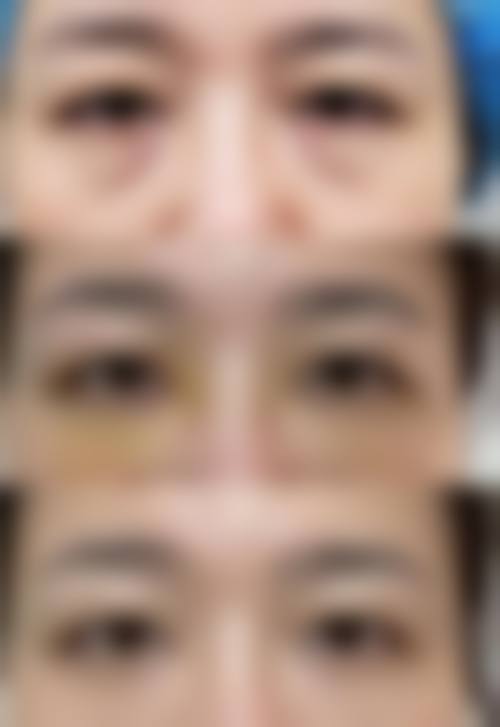 优惠活动详情,助力美丽圆梦