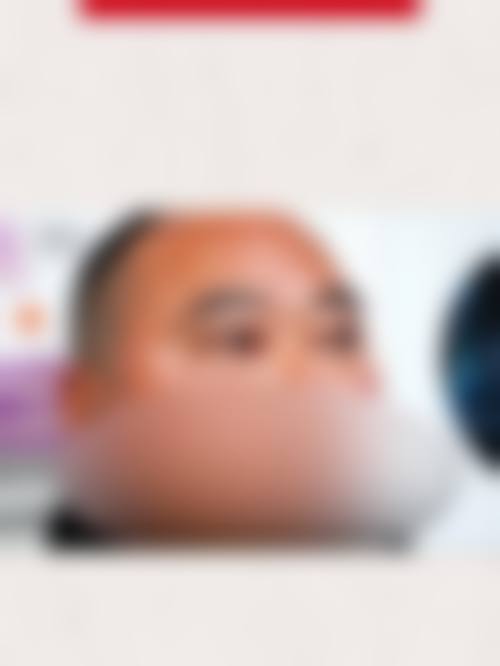 昆明眼科医院（有限公司）预约挂号方式。