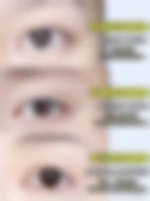 总结:为何选择韩国BN整形外科?