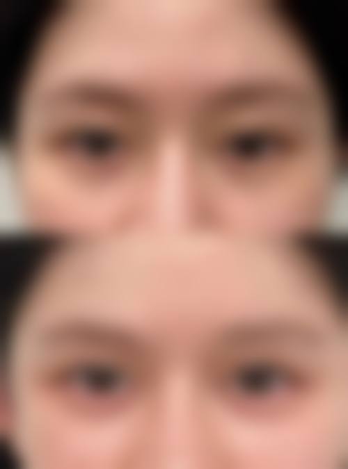 佛山花禧新医疗美容诊所治疗反馈与口碑评价。