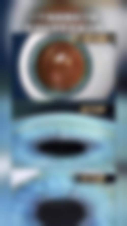 患者真实评价