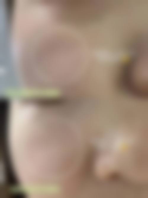 患者真实评价
