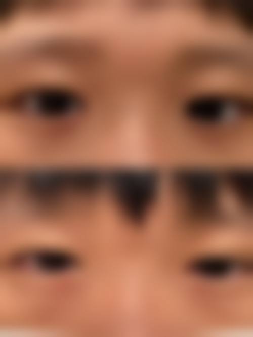 台州市中医院眼科医生团队经验稳定。
