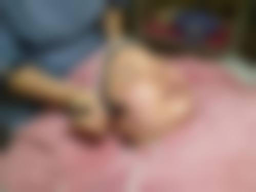 深圳明莱医疗美容诊所治疗反馈与口碑评价。
