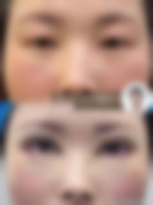 南宁美丽星医疗美容整形医院的预约挂号方式