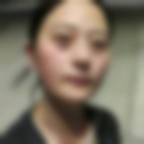 开封市人民医院眼科治疗反馈与口碑评价。