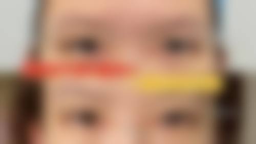 严谨服务流程与患者保护:从检查到术后关怀的全周期管理