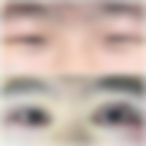 精良诊疗设备与特色项目:精细诊断与微创手术的优势