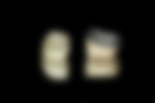 湖南岳阳爱仁口腔医生团队经验稳定。