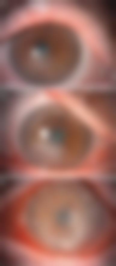 总结:专精眼科,值得信赖