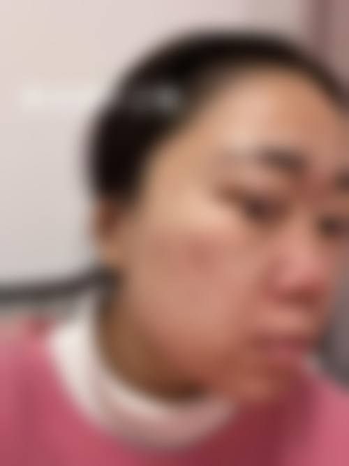设备环境介绍：专精医美硬件保护