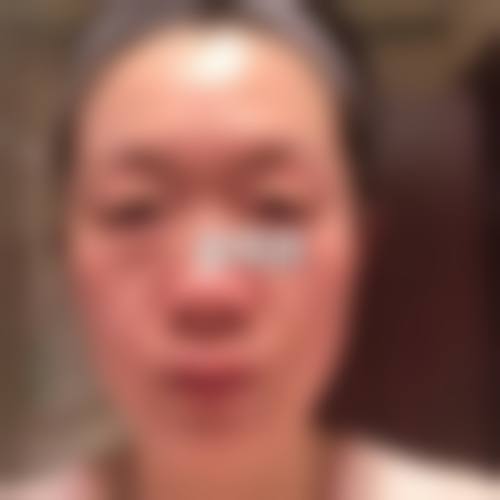 设备环境介绍：国内外前列，安心无菌