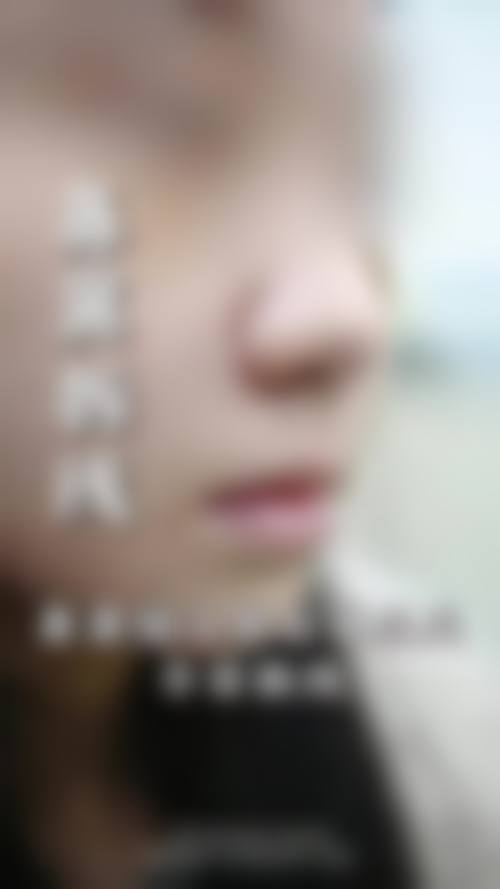 西安艺美医疗美容治疗反馈与口碑评价