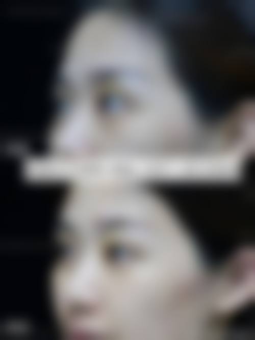 广州慕美整形医院预约挂号方式。