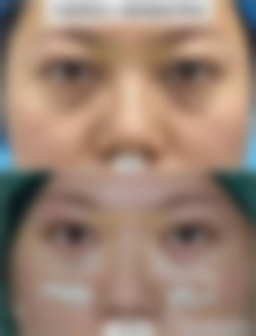 西安艺美医疗美容擅长项目