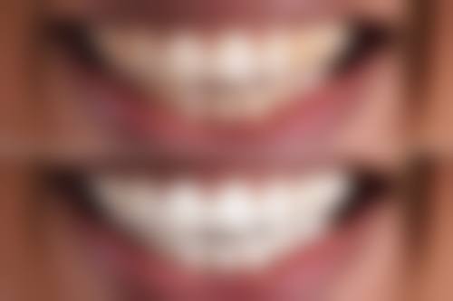 长沙欣颖口腔医生团队经验稳定