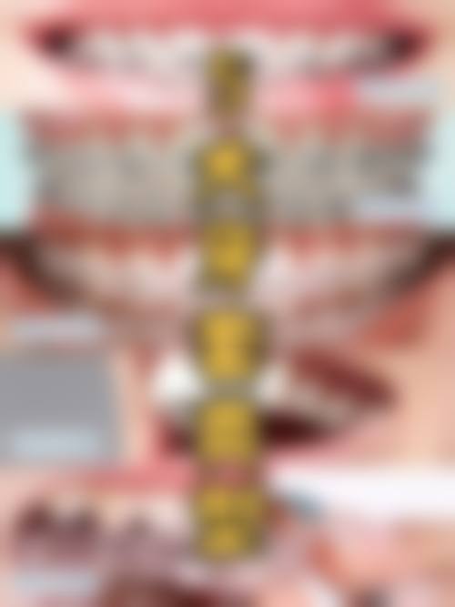 长沙欣颖口腔擅长项目