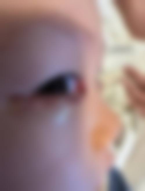 临床实例分享