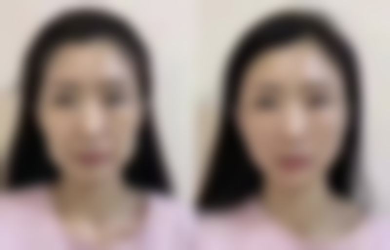 佛山瑞芙臣梦露医学整形美容医院SarahKim医生口碑评价如何?