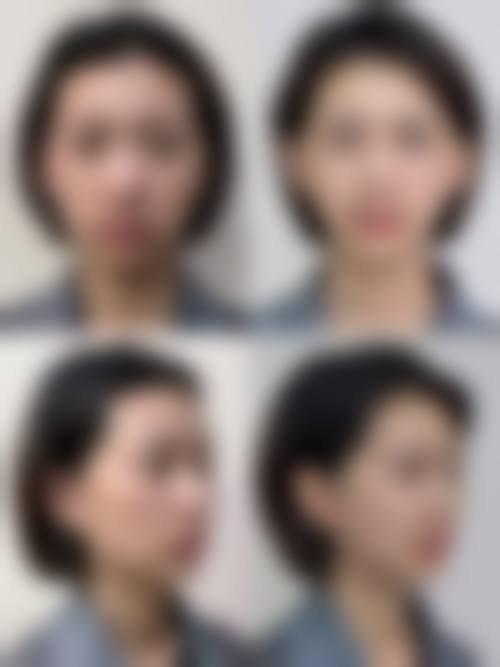 安徽省蚌埠医学校附属医院医生团队经验稳定。