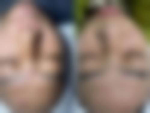 优惠活动详情:限时特别优惠,预约从速