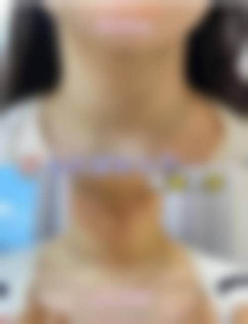韩国THE BB整形外科治疗反馈与口碑评价。