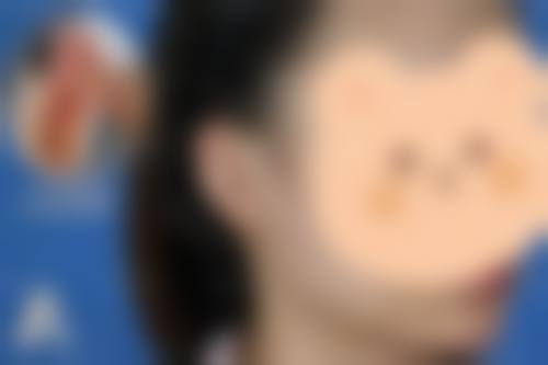 临床实例分享